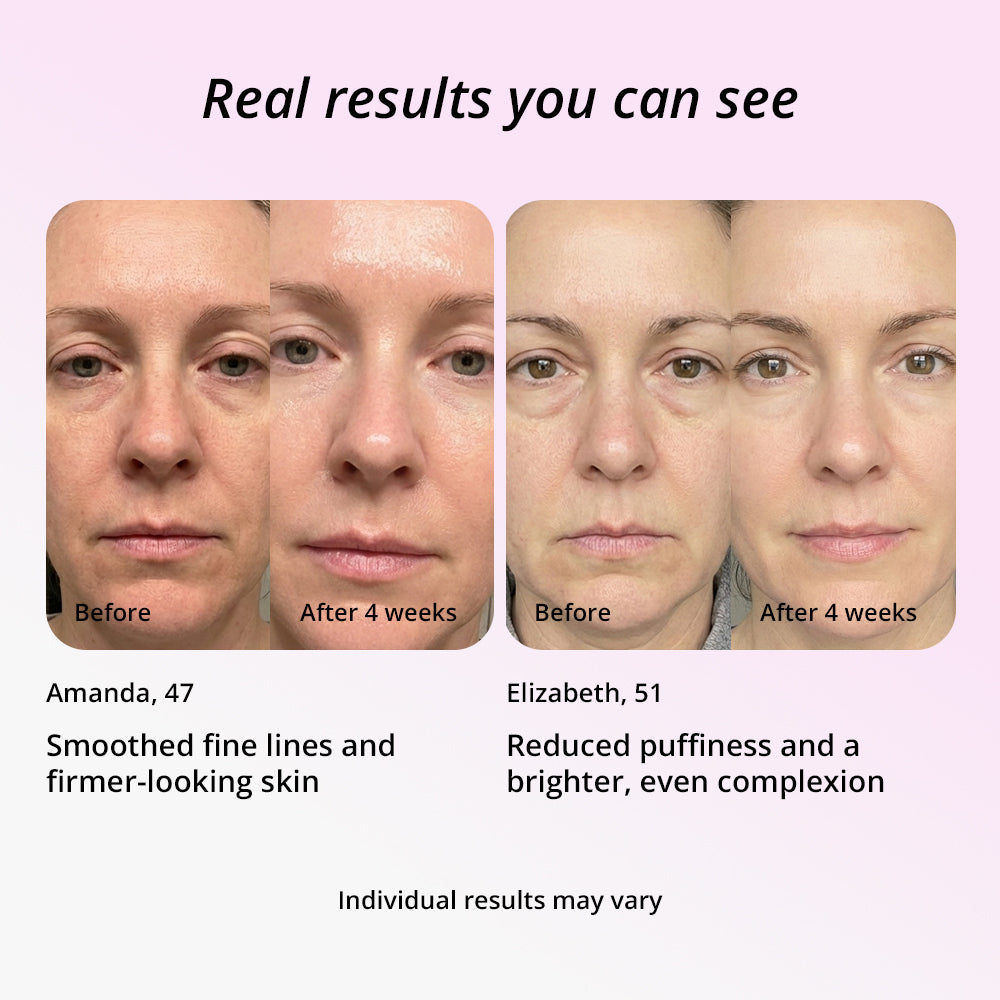 Light Therapy Skincare Wand