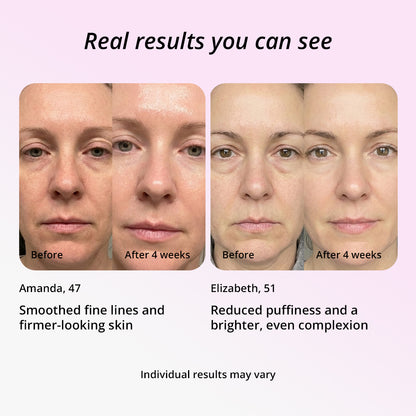 Light Therapy Skincare Wand